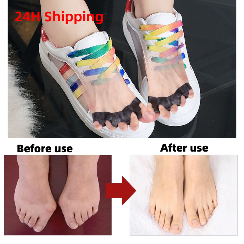 Yoga Toe Separator - 40Pairs Silicone Toe Spacers for Proper