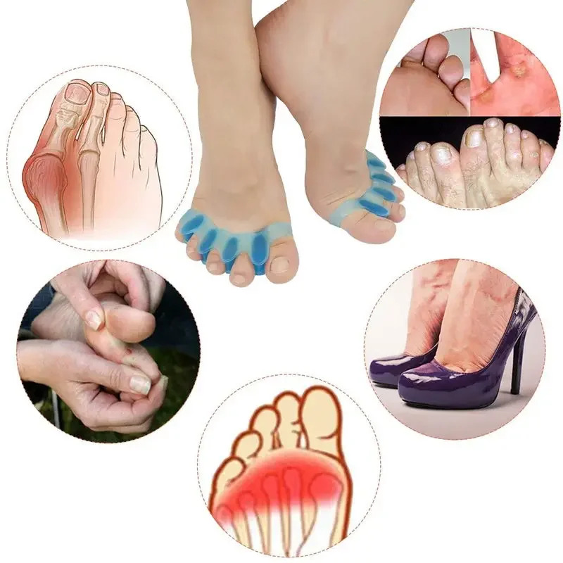 2Pcs=1Pair New Protective Toes - Yoga Toe Separator recension och pris