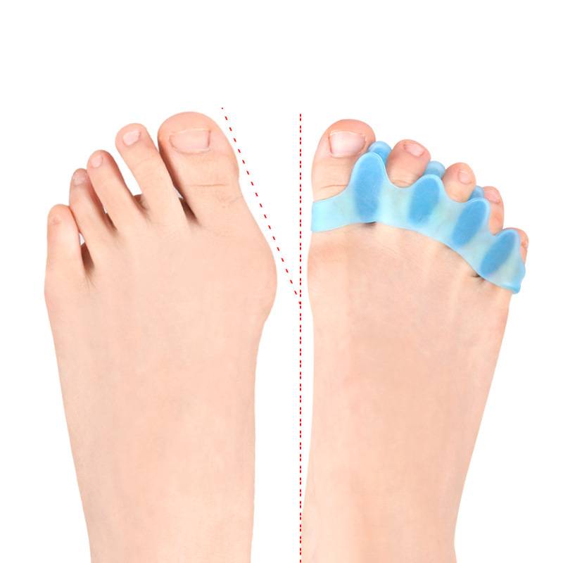 1/5Pairs Silicone Toe Separato - Yoga Toe Separator recension och pris
